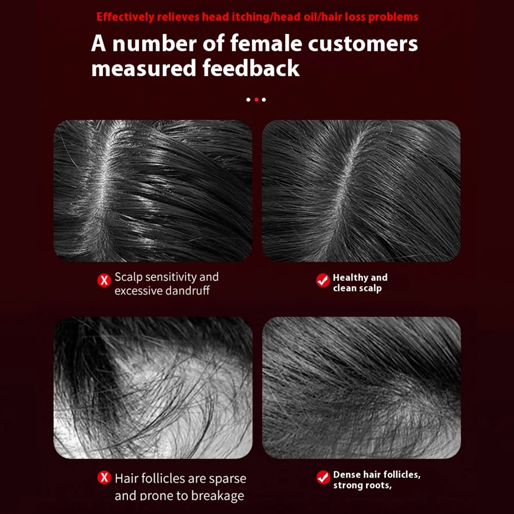 Anti-Hair Loss Head Massager Comb - The Gentle Scalp Therapy For Healthier Hair